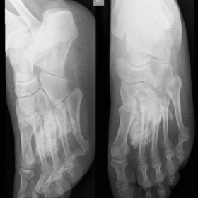 X-Ray oblique, face and lateral