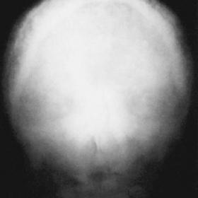 X-rays of case 1166