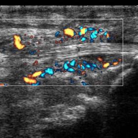 Ultrasonography of the ankle