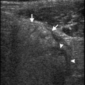 Abdominal ultrasonography