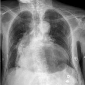 Conventional radiography of the chest
