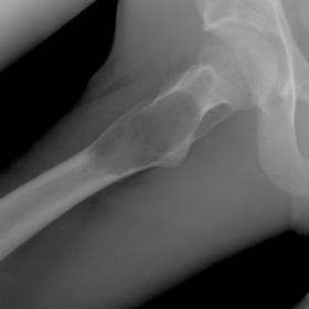 Radiography of the Proximal Right Femur