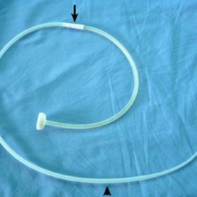 Over-the-wire push-gastrostomy (MIC.Kimberly-Clark/Vygon, Cirencester, UK)