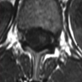 Axial and sagittal T1-weighted images