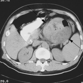 CT of the abdomen