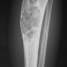 Frontal left lower limb radiograms