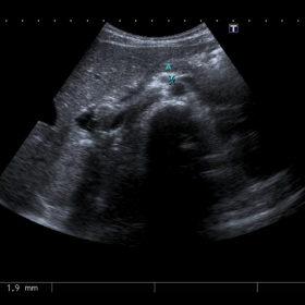 Ultrasound exam using Doppler