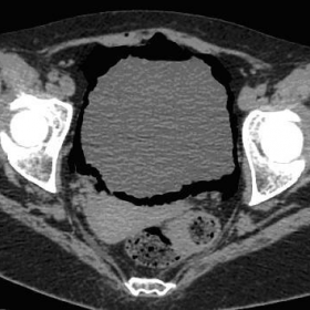 Axial CT images soft window