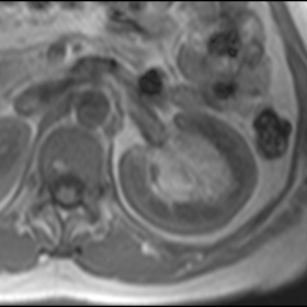 MRI - T1-weighted imaging