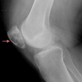 Plain radiograph of knees