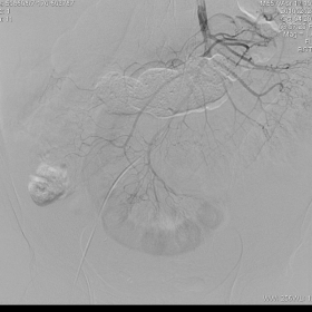 Control angiography