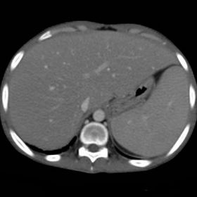 Initial abdominal contrast-enhanced multidetector CT