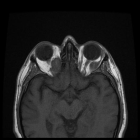 MR T1-weighted  images