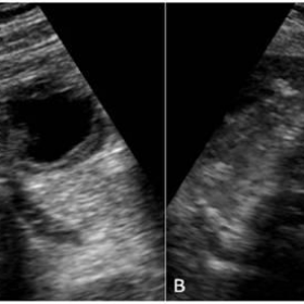 Abdominal ultrasonography scans in axial (a) and longitudinal planes (b).