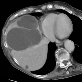 Initial contrast-enhanced CT including multiplanar image reformations