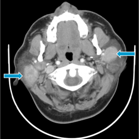 Contrast enhanced axial CT images