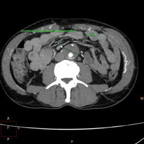 Axial CT views with CM