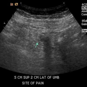 Abdominal Ultrasonography