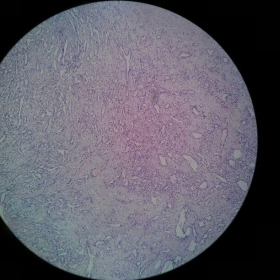 Histology images of the lesion