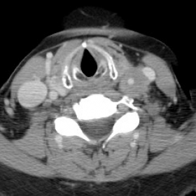 Contrast enhanced CT images