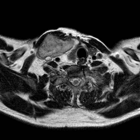 Contrast-enhanced MRI
