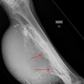 Plain radiograph of the right lower leg