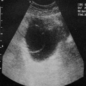 Ultrasound image of the pelvis