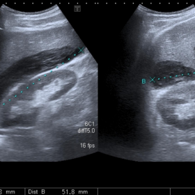 Abdominal ultrasonography