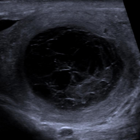 Conventional ultrasonographic findings