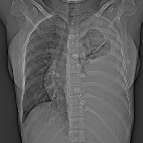 Topographic image of thorax