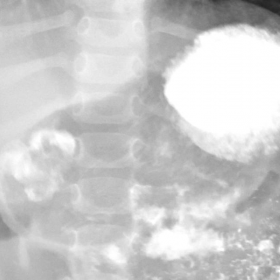 Conventional radiography with oral contrast