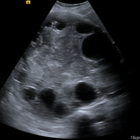Abdominal ultrasound 1