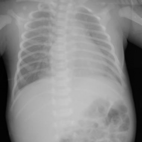 Digital Radiograph of the chest