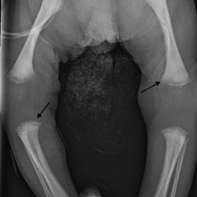 AP Radiograph of the lower extremities