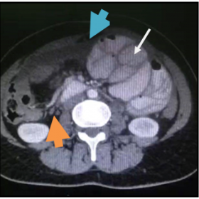 Axial  CT images