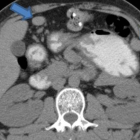 Axial CT images