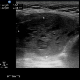 Ultrasound image 1