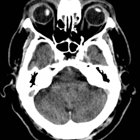 Axial CT head.
