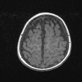 Axial T1-weighted MRI