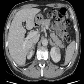 Axial contrast-enhanced CT images