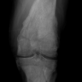 X-ray of the lower limb