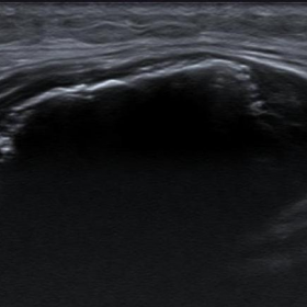 Ultrasound (Figs. 1a and 1b)