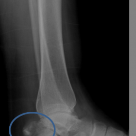 Conventional Radiograph - Ankle