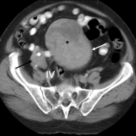 Axial post-contrast CT images
