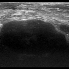 Ultrasound in B-mode and Colour Doppler evaluation