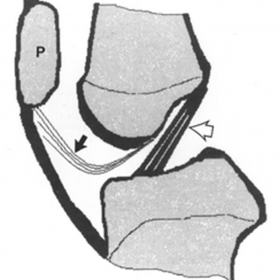 Normal anatomy of the infrapatellar plica