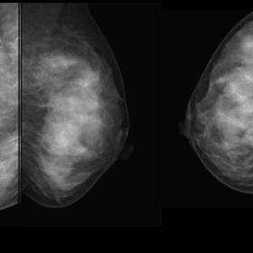 Mammography at initial visit