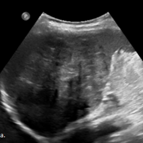 Ultrasonography of the spleen showed: (a) a bulky spleen with an ill-defined round heteroechoic mass lesion with a central echogenic scar; and (b) internal vascularity.