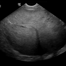 Initial Ultrasound