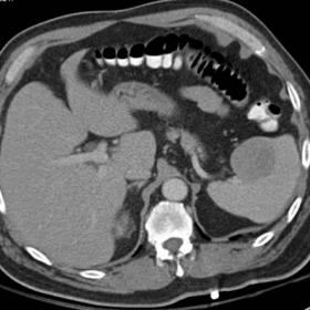 CT examination performed with oral and intravenous contrast material